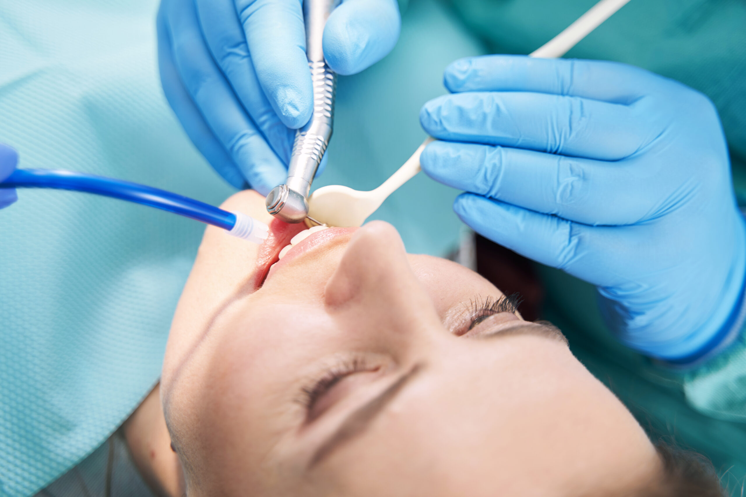 Cura dei denti